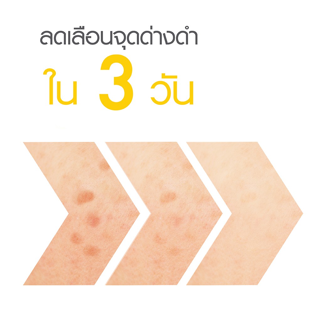 การ์นิเย่ ไลท์ คอมพลีท วิตามินซี บูสเตอร์ เซรั่ม 30 มล. Garnier Light Complete Vitamin C Booster Serum #8