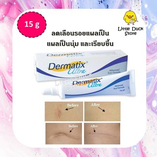 [ ฉลากไทย ] Dermatix Ultra Gel 15 g เดอร์มาติกซ์ อัลตร้า เจล ป้องกันรอยแผลเป็น [Exp.05/2025]