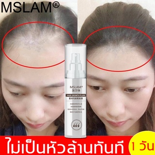 MSLAM 30ml ลิควิคบำรุงเส้นผม สารสกัดจากพืชHair Growth Essence Spray เซรั่มปลูกผม รักษาผม ป้องกันผม