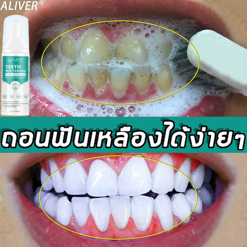 【มีสินค้าพร้อมจัดส่ง】ALIVER มูสแปรงฟัน 60ml สะอาดปาก ลมหายใจสดชื่น เซรั่มฟอกฟันขาว มูสแปรงฟันขาว น้ำยาฟอกสีฟัน ยาสีฟัน