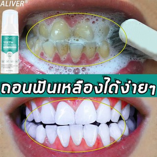 【มีสินค้าพร้อมจัดส่ง】ALIVER มูสแปรงฟัน 60ml สะอาดปาก  ลมหายใจสดชื่น เซรั่มฟอกฟันขาว มูสแปรงฟันขาว น้ำยาฟอกสีฟัน ยาสีฟัน