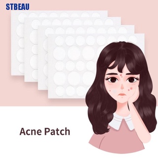 [STBEAU1] แผ่นสติกเกอร์แปะสิว ดูดซับ Pus และ Oil Acne Patch MME