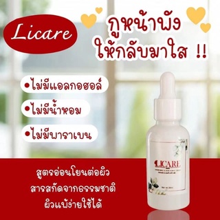 เซรั่มสิวฝ้า,อ่อนโยนต่อผิว,กูหน้าพังให้กลับมาใส