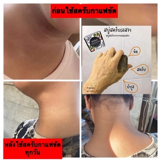 สบู่ขัดคอดำ แขนดำ ขาดำ ตูดดำ