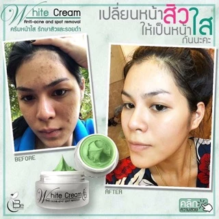 White Cream anti-acne ( บีมิราเคิลครีม) ครีมหน้าใส ครีมลดสิว•ขนาดทดลอง5กรัม•