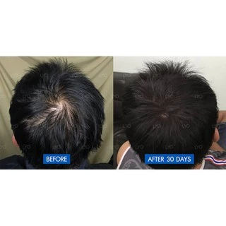 LYO ไลโอ หนุ่มกรรชัย #ส่งจากบริษัท | ครบชุด แฮร์โทนิค แชมพู ครีมนวด lyo shampoo lyo hair tonic ช่วยลดผมร่วง