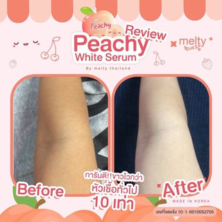 เซรั่มพีชชี่ Peachy 10ซอง/กล่อง ของแท้ ลูกพีชเกาหลี เซรั่มลูกพีช #โละ ล้าง สต๊อก ด่วนก่อนหมด!!!