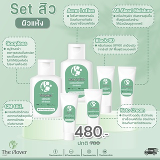 Set รักษาสิว (เหมาะสำหรับผิวแห้ง)