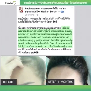 เเชมพูแก้ผมร่วง150ml+ครีมนวดบำรุงผม150ml แก้ผมร่วงผมบาง บำรุงผมนุ่ม ฮาวิล่าห์|Conditioner Havilah+Shampoo