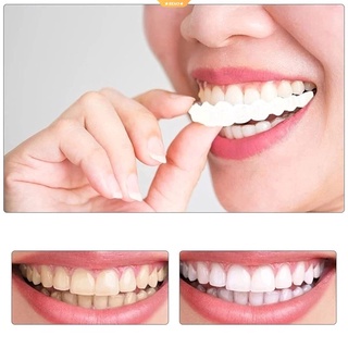 Snap On Teeth Cover Perfect Smile Fit ขนาดเดียวเหมาะกับฟันปลอมที่สะดวกสบายที่สุดเพื่อให้ฟันขาวสวยงาม Neatr-BK