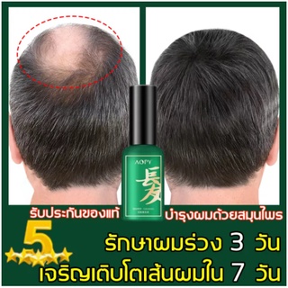 น้ำยาเร่งผมยาว ตัวช่วยดีแก่ผมร่วง AOPY เซรั่มปลูกผม 30ml เหมาะสำหรับไรผมขึ้น ผมร่วงหลังคลอด ผมร่วงเป็นหย่อม ผมร่วงนอนดึก