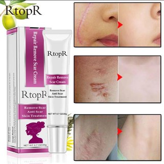 *ส่งจากไทย*RtopR Scar gel acne scar stretch mark cream ครีมลดรอยแผลเป็น รอยแผลเป็น ลบรอยแผลเป็น รักษารอยแผลเป็น