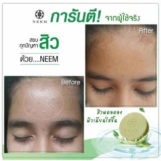 NEEM Bright &amp; Clear Acne Soap 50g.  สบู่นีม สบู่สิวหลุด บอกลาหน้าสิว สู่หน้าใส