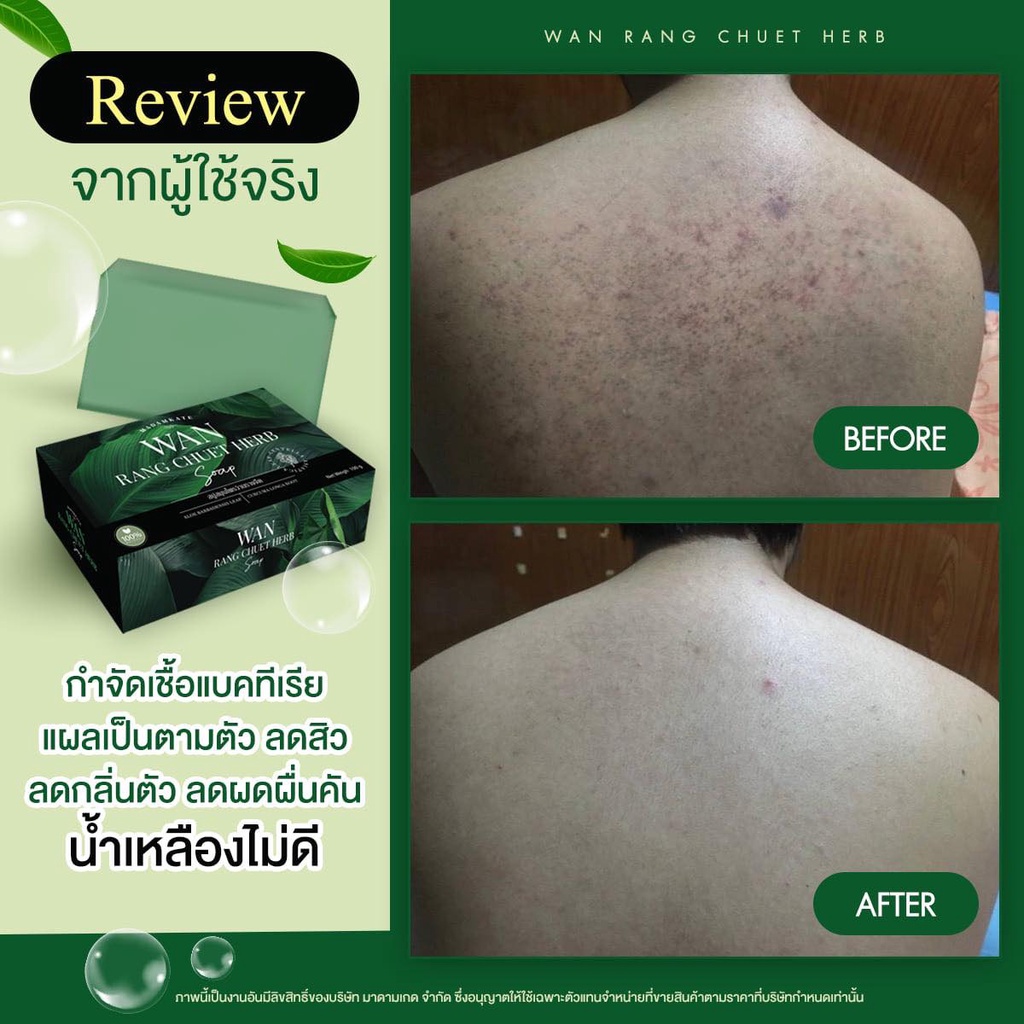 สบู่ว่านรางจืด บชรรเทาอาการคันตามผิวหนัง เชื้อรา กลากเกลื้อน คอดำ ขาหนีบดำหายขาด สบู่สมุนไพร