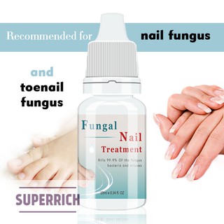 Onychomycosis ครีมบำรุงเล็บ 1 ชิ้น