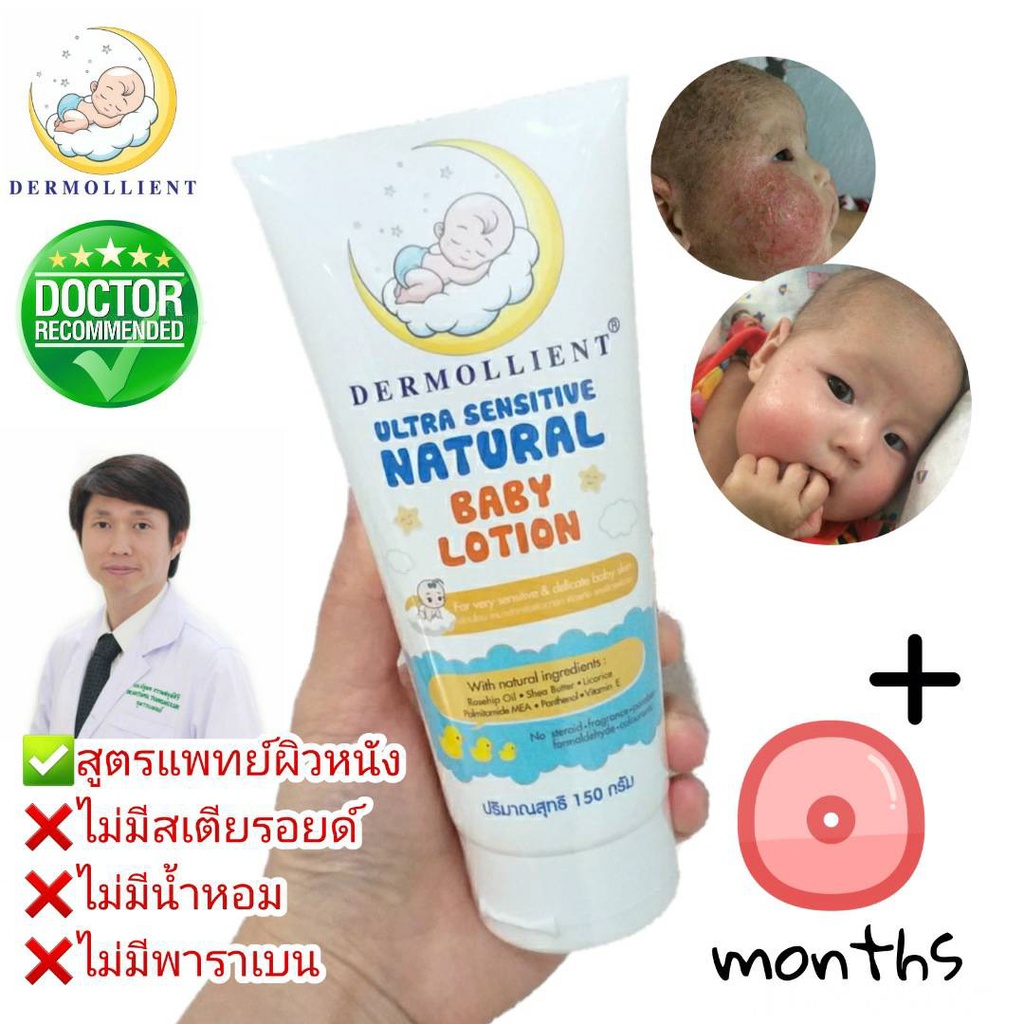 🌟สูตรหมอ ลดผื่นภูมิแพ้คัน Dermollient Ultra​ Sensitive​ Natural​ Baby​ Lotion​ (150​ กรัม​) โลชั่นเด