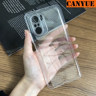 Xiaomi Redmi K40 Gaming Edition Note 10 Pro 10T 5G 10s K40Pro Note10Pro Note10s Transparent TPU Case Soft Clear Silicon Back Cover Protection Phone Casing for RedmiK40 RedmiK40Pro RedmiNote10 RedmiNote10Pro (5G) K 40 Gaming