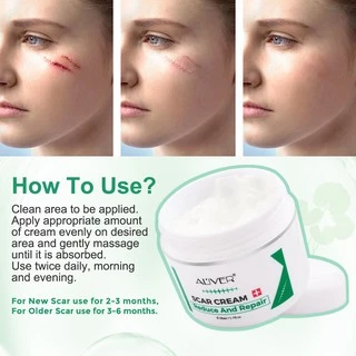 ของแท้ ALIVER ครีมลดรอยแผลเป็น แผลเป็น รแผลไฟไหม้ น้ำร้อนลว แผลผ่าตัด รอยแตกลายหลังครรภ์ แผลเป็นใหม่และแผลเป็นเก่า 50ml