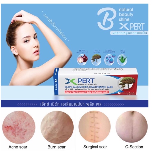 สูตรใหม่ เพิ่มเจลเลือดมังกรXpert Scar X Pert gel "ลดริ้วรอย หลุมลึก" 10g MCK Dragon blood #รอยสิว #ห