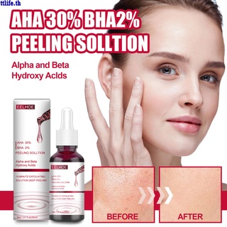 【ANDES】Face Peeling Solution AHA 30% + BHA 2% Fruit Acid Salicylic Acid Acne Removing Serum Repair Hyaluronic Acid Face Skin Care 30ml