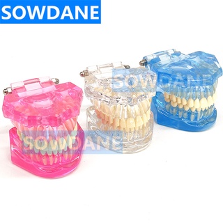 1pc Dental Standard Tooth Model Orthodontic Model for Patient Communication Dental Study Clinic Model Tool