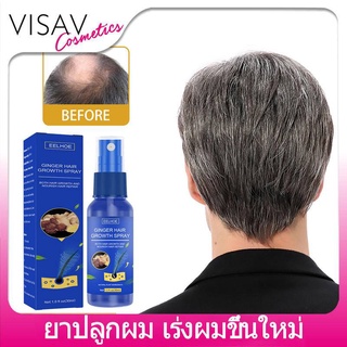 ​EELHOE 30ML ยาปลูกผม เร่งผมขึ้นใหม่ เร่งผมยาวไว แก้ปัญหาผมร่วง ลดผมร่วง （เซรั่มปลูกผม น้ำยาเร่งผมยาว น้ำยาปลูกผม สเปรย์ปปลูกผม สเปรย์ปลูกผม น้ำยาปลูกผมดก ยาปลูกผมผู้ชาย น้ำยาใส่ผม เซรั่มเร่งผมยาว ครีมปลูกผม ยาปลูกผมดกหนา ปลูกผมเร่งด่วน )