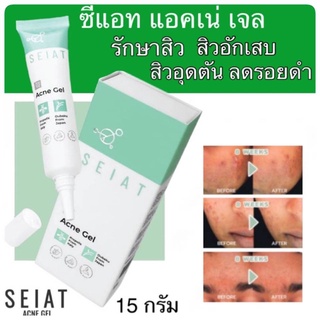 เจลแต้มสิว ซีแอท แอคเน่ เจล 15 ml SEIAT Acne gel 15 ml บำรุงผิวที่เป็นสิว ลดการเกิดสิวใหม่ เหมาะกับผิวแพ้ ระคายเคือง