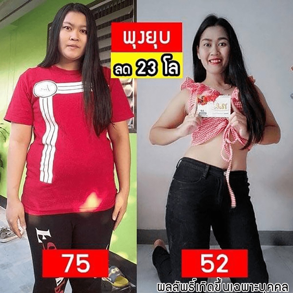 🔥[พร้อมส่ง+มีโค๊ดลด] 🔥 โนบุพลัสอาหารเสริมควบคุมน้ำหนัก อิ่มนานเบิร์นไว พุงยุบกระชับสัดส่วนไม่โยโย่ - รูปที่ 4