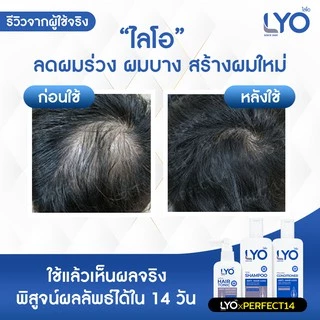 LYO ไลโอ หนุ่มกรรชัย สั่งได้ดั่งใจ| #ส่งฟรี #ครบทุกชุด! (เซรั่มแฮร์โทนิค+แชมพู+ครีมนวด) แก้ผมหลุดร่วง บำรุงผมสร้างผมใหม่