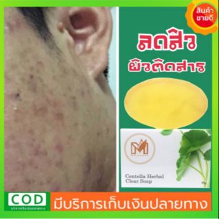 สบู่ใบบัวบก ลดสิว ผิวติดสาร