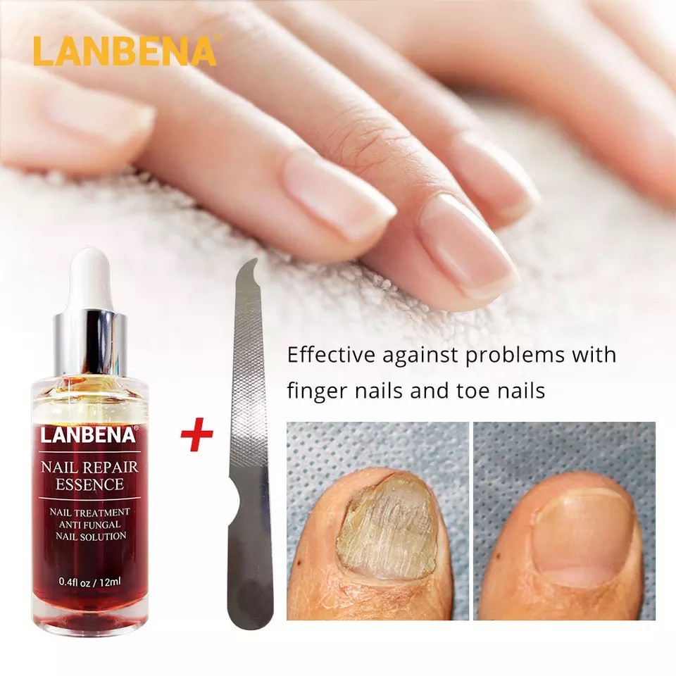 LANBENA เอสเซ้นส์ซ่อมแซมเล็บ Fungal Nail Treatment ลบ Onychomycosis Toe Nourishing Brighten Hand Foot Skin Care - รูปที่ 7