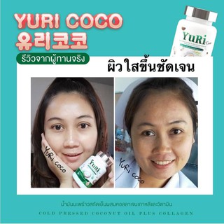 💥2 กระปุก💥น้ำมันมะพร้าวสกัดเย็น ยูริโคโค่ yuri coco คลอลาเจน ลดน้ำหนัก ผิวขาวใส  ปลอดภัยมี อ.ย. **มีของแถมทุกออเดอร์*