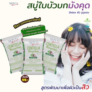 SKIND -สบู่สมุนไพรมังคุดและใบบัวบก  ลด P Acne คุมมัน ต่อผิว ลดการอักเสบ ลดสิวหิน สบู่ไพรเย็น สูตรเย็น