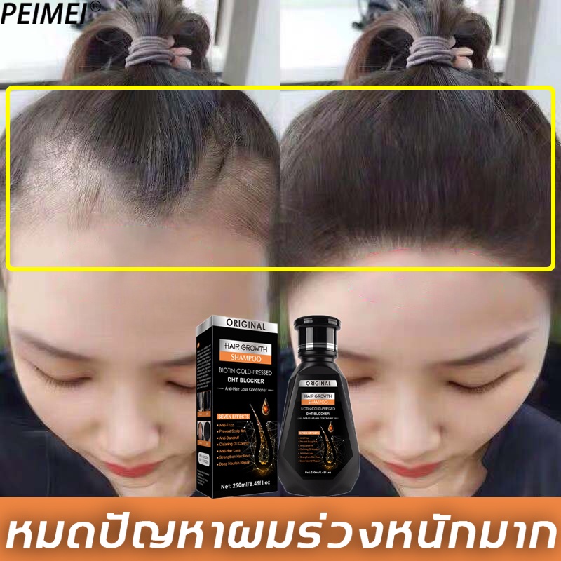 【มีสินค้าพร้อมจัดส่ง】PEIMEI แชมพูสมุนไพรขิงบำรุงผม แชมพูขิงเพียว 250ML ยาสระผมแก้ร่วง แชมพูขจัดรังแค แชมพูสมุนไพร