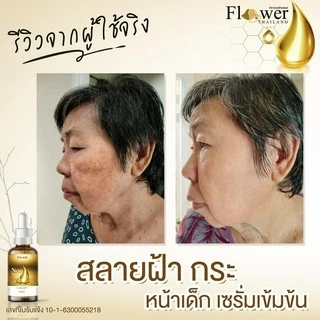 [ส่งฟรี/ของแท้] *1แถม1* Nano Serum เซรั่มนาโน แก้ฝ้า หน้าคล้ำ รอยสิว รอยดำ ผิวกระจ่างใส ของแท้100%