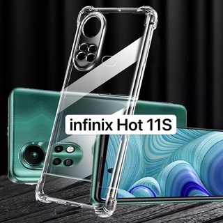 [ เคสใสพร้อมส่ง ] Case Infinix Hot 11S เคสโทรศัพท์ อินฟินิ๊ก เคสใส เคสกันกระแทก case infinix Hot11S