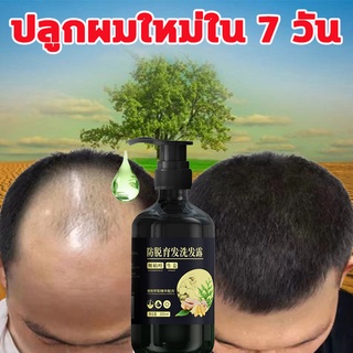 ยาสระผมแก้ผมร่วง ZHENXIU แชมพูลดผมร่วง 300ml ผมร่วง ลดผมร่วง หยุดผมร่วงและเร่งผมงอกใหม่  แชมพูผมร่วง เซรั่มผมร่วง