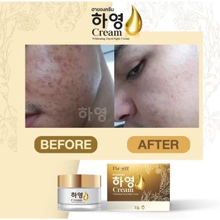[เก็บโค้ดส่งฟรี+พร้อมส่ง]Hayeong ฮายอง ของแท้จากโรงงาน⭐ 하영สกัดจากโสมเกาหลี หน้าใส แก้ฝ้า หน้าคล้ำ 🇰🇷 ริ้วรอย จุดด่างดำ