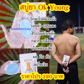 สบู่ยา รักษาโรคผิวหนัง OK YOUNG