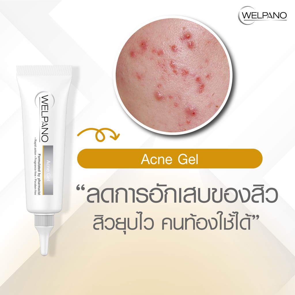 Welpano Acne Gel For Sensitive Skin เจลแต้มสิวสูตรอ่อนโยนขนาดพก — صورة 4