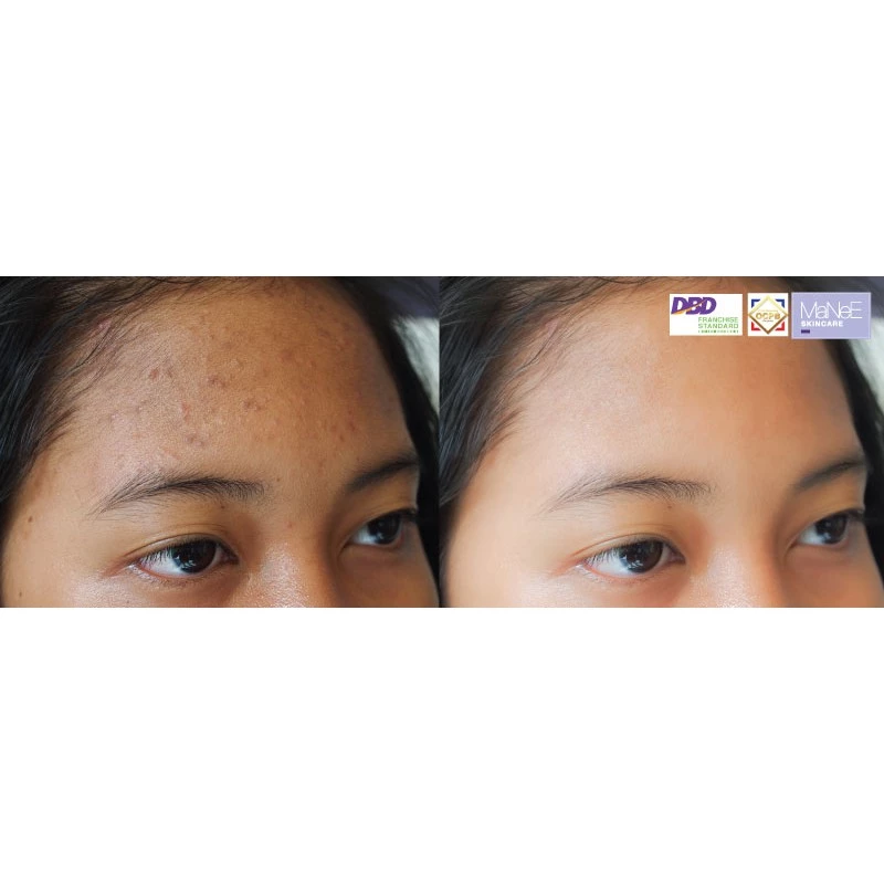 Manee Skincare ยูโรคิดส์เอสเซ้นท์เซรั่ม 15 มล. thumbnail 6