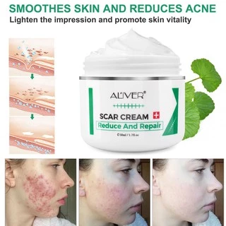 ของแท้ ALIVER ครีมลดรอยแผลเป็น แผลเป็น รแผลไฟไหม้ น้ำร้อนลว แผลผ่าตัด รอยแตกลายหลังครรภ์ แผลเป็นใหม่และแผลเป็นเก่า 50ml