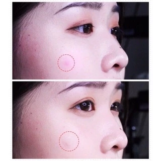(แท้ 💯 พร้อมส่ง) แผ่นแปะสิว OLIVE YOUNG Care Plus Spot Patch