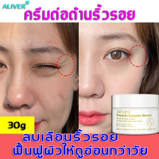 ALIVER ครีมลดริ้วรอย 30g (ครีมต่อต้านริ้วรอย ครีมลดริ้วรอยต่อต้านริ้วรอย ครีมลดริ้วรอยร่องลึก ครีมลดริ้วรอยบนใบหน้า）