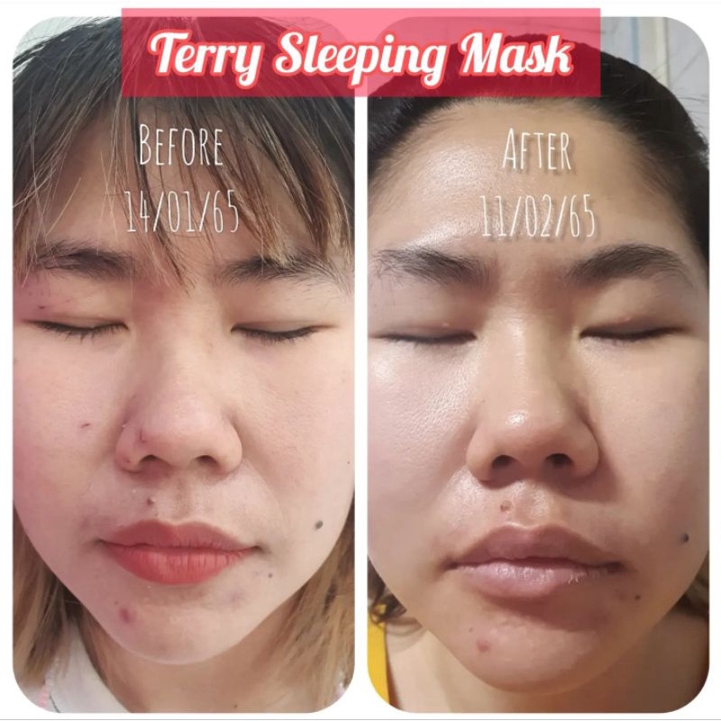 (พร้อมส่ง) เธอร์รี่ สลีปปิ้ง มาร์ค Terry Sleeping Mask