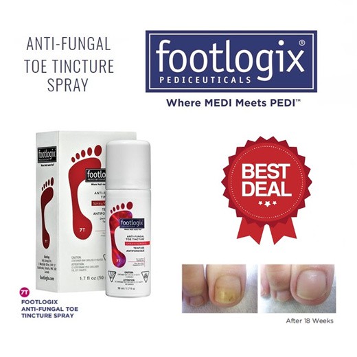 Footlogix Nail Tincture Spray 7T Anti fungal 50ml red ฟุตโลจิสต์ สเปรย์ รักษาเชื้อรา เล็บเท้า บำรุงเล็บ เล็บเหลือง สีแดง