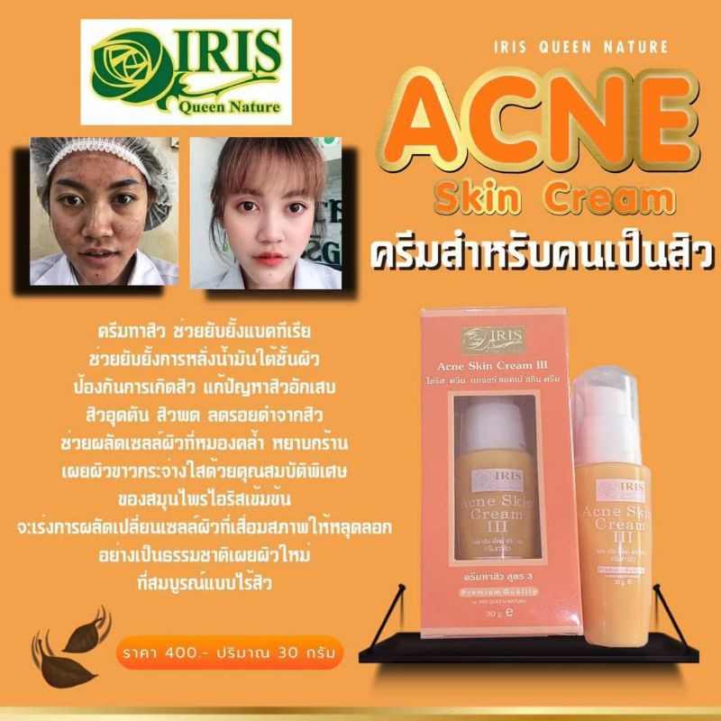 (ครีมสิว) ไอริส ควีน เนเจอร์ สั่งซื้อในวีดีโอร้านมีส่วนลด25%ค่ะ ราคา ถูกที่สุด ดีลบีเคเค แกลเลอรีภาพที่ 8