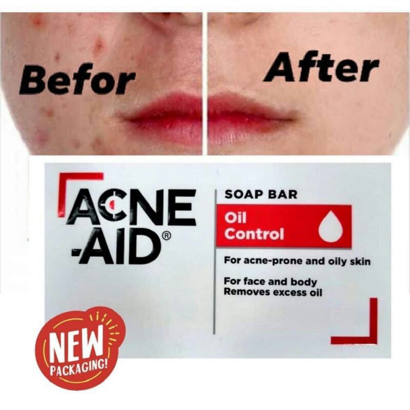 Acne-Aid bar soap 100g. สบู่ก้อน Acne-Aid เหมาะสำหรับผิวแพ้ง่าย เป็นสิวง่าย EXP 08/2025.