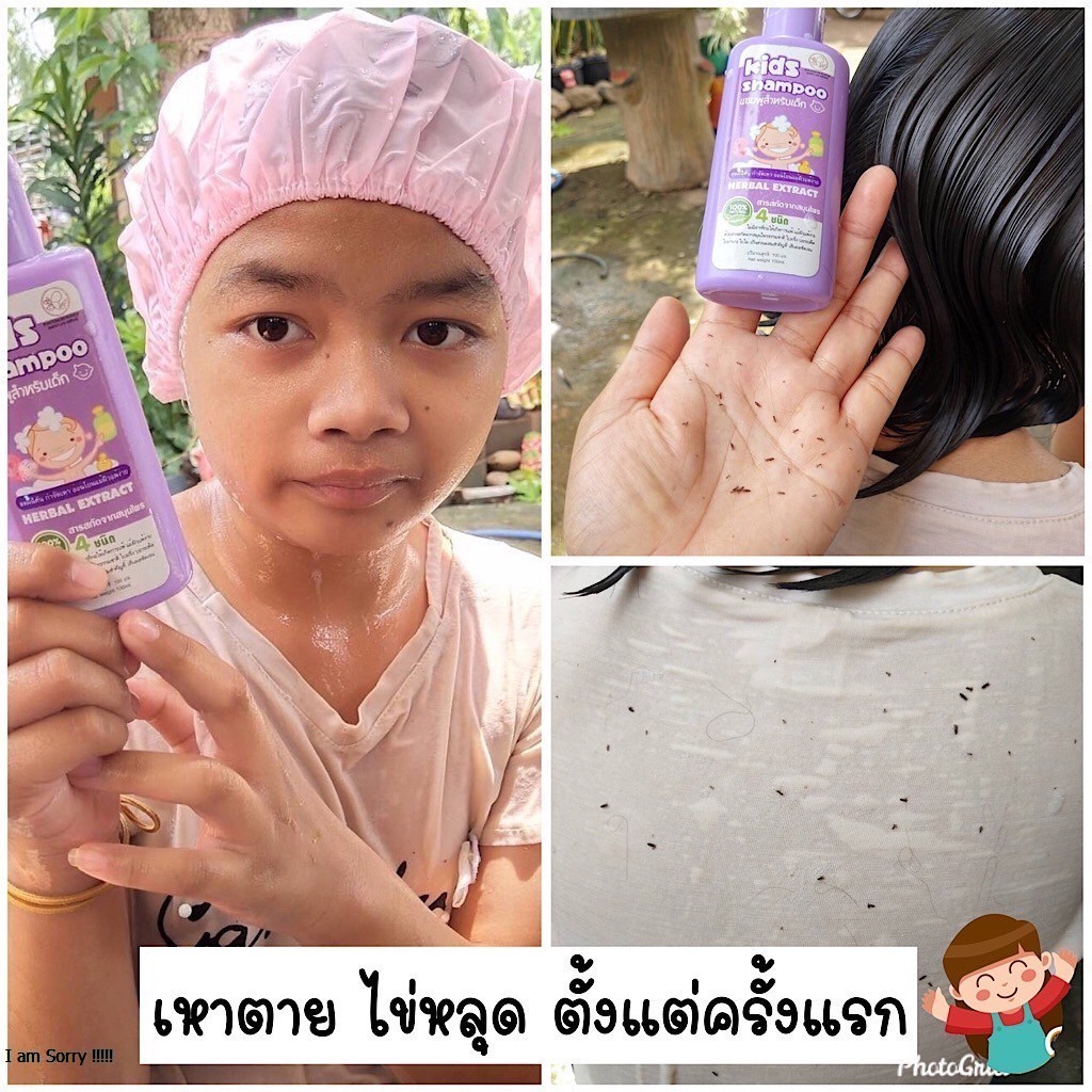 แชมพูเหา ฟรี‼️หวีสาง+หมวกคลุม สำหรับคนเป็นเหา สูตรสมุนไพร อ่อนโยน 1ขวบใช้ได้ - รูปที่ 3