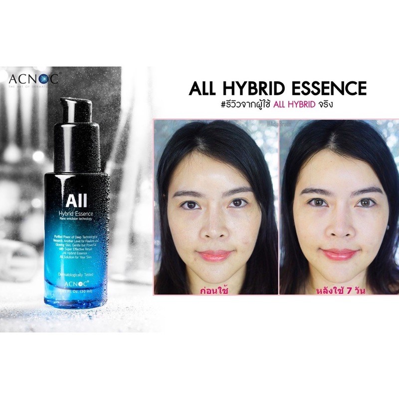 ACNOC ALL HYBRID ESSENCE 30 ML.สินค้าพร้อมส่ง ของเเท้100 - shin.jenny ...